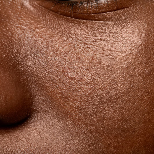 Os melhores exfoliantes para pele oleosa & como usá-los