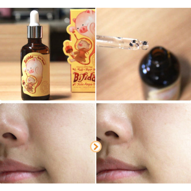 Elizavecca Witch Piggy Hell-Pore Bifida Pure Ample - Korean-Skincare